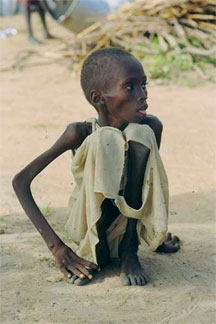 starving_child-sudan